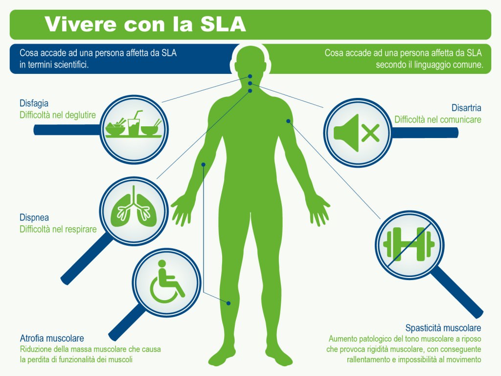 Info sulla SLA